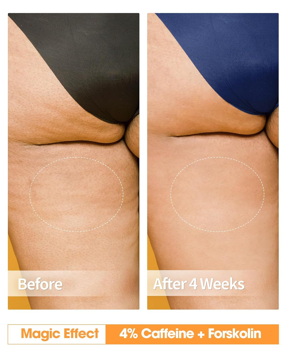 Transform Your Skin with Our Anti Cellulite Cream - Firming, Moisturizing, and Enriched with 4% Caffeine and Forskolin for Ultimate Tightening and Smoothness in a 5.4 Oz Jar